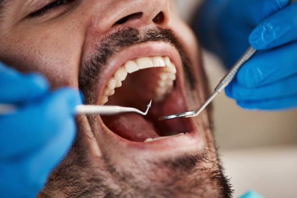 Best Dentist for Tooth Abscess  in North Wildwood, NJ